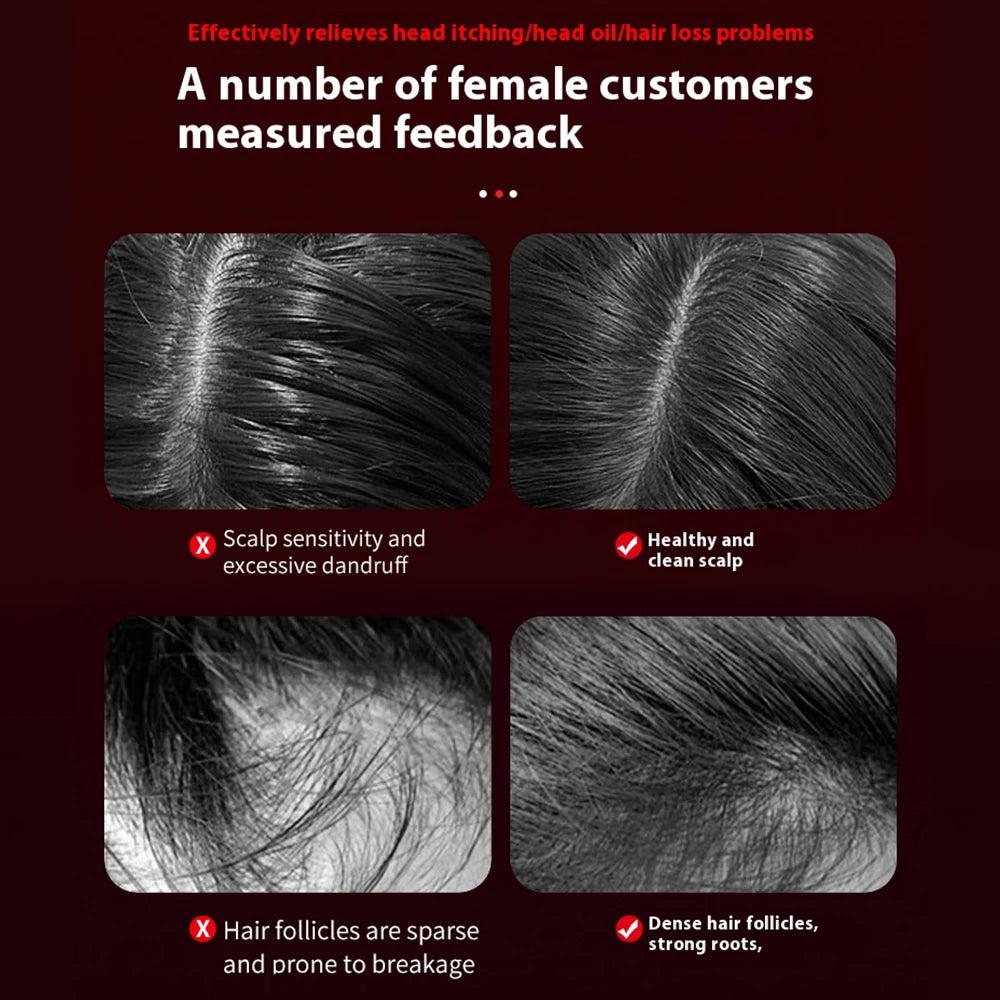 Cepillo Eléctrico Luz Infrarroja| Anticaída | Masajeador Crecimiento